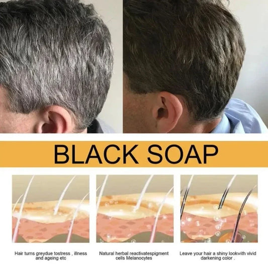 https://ynhrnsmwlsrihguevngr.supabase.co/storage/v1/object/public/assets/medias/35dd801e-dd58-48d6-899f-fcf276be1dcd.webp